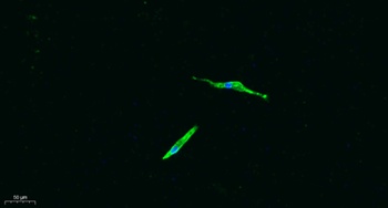 CD4 antibody