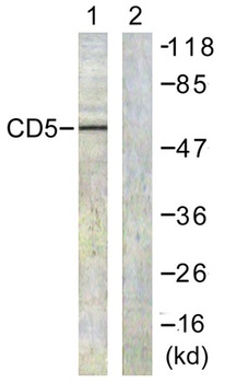 CD5 rabbit pAb Antibody