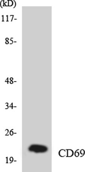 CD69 antibody