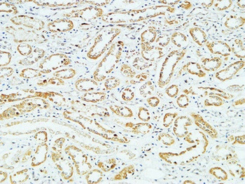 CD83 rabbit pAb Antibody