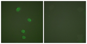 CDC46 rabbit pAb Antibody