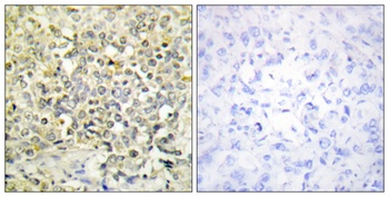 CdkL4 rabbit pAb Antibody