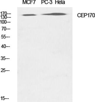 CEP170 antibody