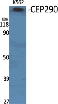 CEP290 antibody