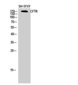 CFTR rabbit pAb Antibody