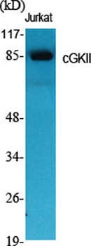 cGKII antibody