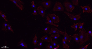 ChemR23 antibody