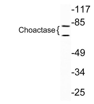 Choactase rabbit pAb Antibody