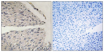 CIDE-B rabbit pAb Antibody