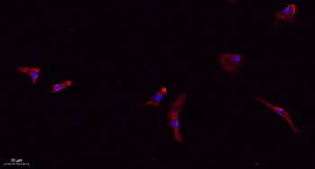 Claudin 1 antibody