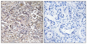 Claudin-6 rabbit pAb Antibody
