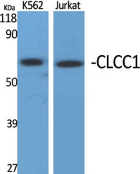 CLCC1 antibody