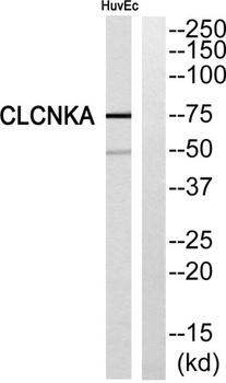 CLC-KA rabbit pAb Antibody