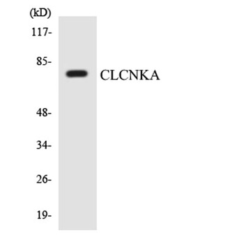 CLC-KA rabbit pAb Antibody