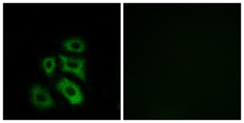CLIP3 rabbit pAb Antibody