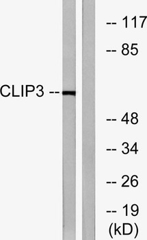 CLIP3 rabbit pAb Antibody