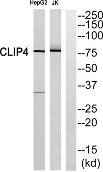 CLIP4 rabbit pAb Antibody