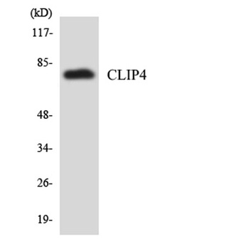 CLIP4 rabbit pAb Antibody