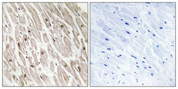 CLK4 rabbit pAb Antibody