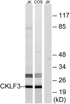 CMTM3 rabbit pAb Antibody