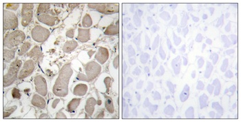 COL5A1 rabbit pAb Antibody