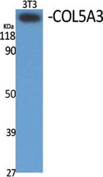 COL5A3 rabbit pAb Antibody