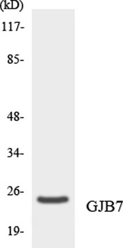 Connexin 25 rabbit pAb Antibody