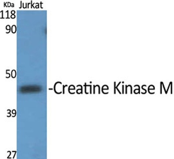 Creatine Kinase M antibody