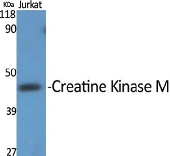 Creatine Kinase M rabbit pAb