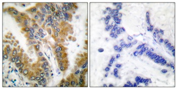Crk-L rabbit pAb Antibody