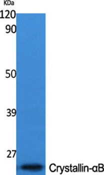 Crystallin-alpha B antibody
