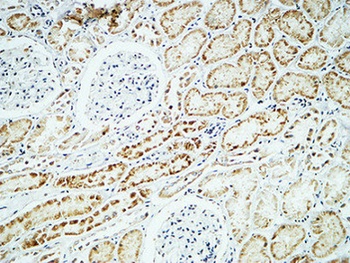 Crystallin-αB rabbit pAb Antibody