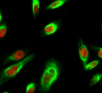 Cyclin D1 rabbit pAb Antibody