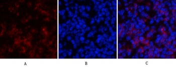 Cyclin D1 rabbit pAb Antibody