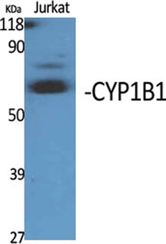 CYP1B1 rabbit pAb