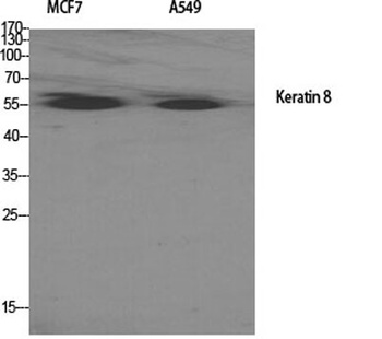 Cytokeratin 8 antibody