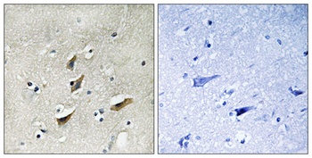 Dematin rabbit pAb Antibody
