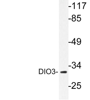 DIO3 rabbit pAb Antibody