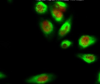 DNMT3B antibody