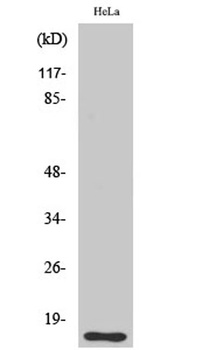 DOC-1 antibody