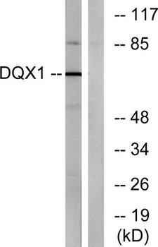 DQX1 rabbit pAb Antibody