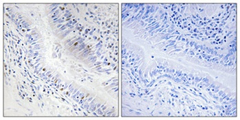 Dynein LC 1 rabbit pAb Antibody