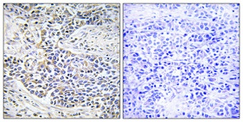 Dynein LC 1 rabbit pAb Antibody