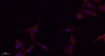 E-cadherin rabbit pAb
