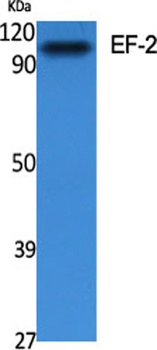EF-2 rabbit pAb Antibody
