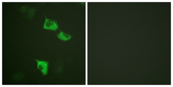 EF-2 rabbit pAb Antibody
