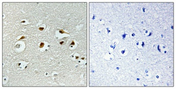 EID-1 rabbit pAb Antibody