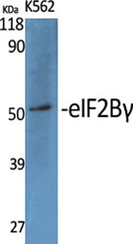eIF2B gamma antibody