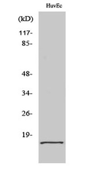 eIF5A2 rabbit pAb Antibody