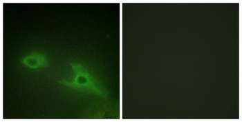 EphA1 rabbit pAb Antibody